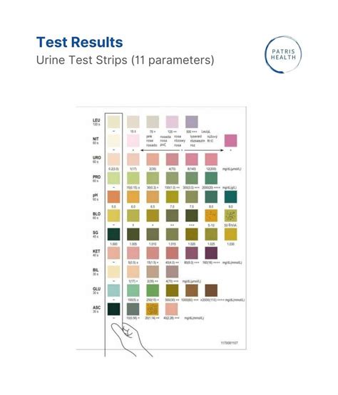 dropping urine strip test|microscopic urine test results.